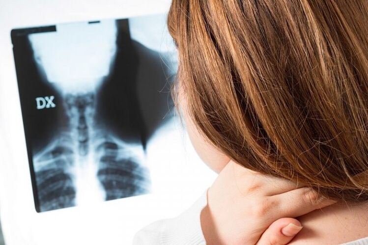 x -ray ของบริเวณปากมดลูก